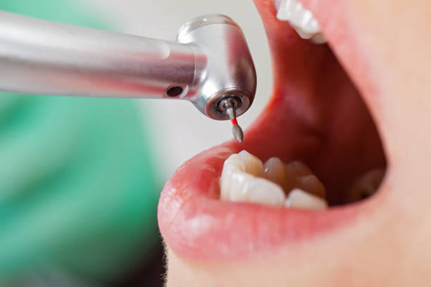 Best Weekend Emergency Dentist in Bradfordville, FL